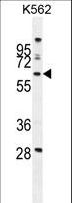 WDR49 Antibody - WDR49 Antibody western blot of K562 cell line lysates (35 ug/lane). The WDR49 antibody detected the WDR49 protein (arrow).