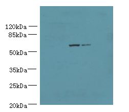WDR49 Antibody - Western blot. All lanes: WDR49 antibody at 7 ug/ml. Lane 1: A549 whole cell lysate. Lane 2: HeLa whole cell lysate. Secondary Goat polyclonal to Rabbit IgG at 1:10000 dilution. Predicted band size: 79 kDa. Observed band size: 79 kDa.