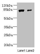 WDR49 Antibody - Western blot All lanes: WDR49 antibody at 7µg/ml Lane 1: A549 whole cell lysate Lane 2: Hela whole cell lysate Secondary Goat polyclonal to rabbit IgG at 1/10000 dilution Predicted band size: 80, 60 kDa Observed band size: 80 kDa