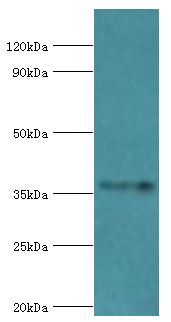 WDR5 Antibody - Western blot. All lanes: WD repeat-containing protein 5 antibody at 2 ug/ml+A431 whole cell lysate. Secondary antibody: Goat polyclonal to rabbit at 1:10000 dilution. Predicted band size: 37 kDa. Observed band size: 37 kDa.