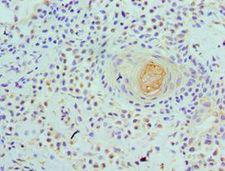 WDR5 Antibody - Immunohistochemistry of paraffin-embedded human breast using antibody at 1:100 dilution.
