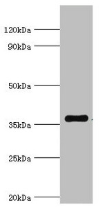 WDR5 Antibody - Western blot All lanes: WDR5 antibody at 2µg/ml + A431 whole cell lysate Secondary Goat polyclonal to rabbit IgG at 1/10000 dilution Predicted band size: 37 kDa Observed band size: 37 kDa