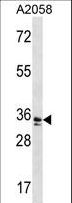 WDR5 Antibody - WDR5 Antibody western blot of A2058 cell line lysates (35 ug/lane). The WDR5 antibody detected the WDR5 protein (arrow).