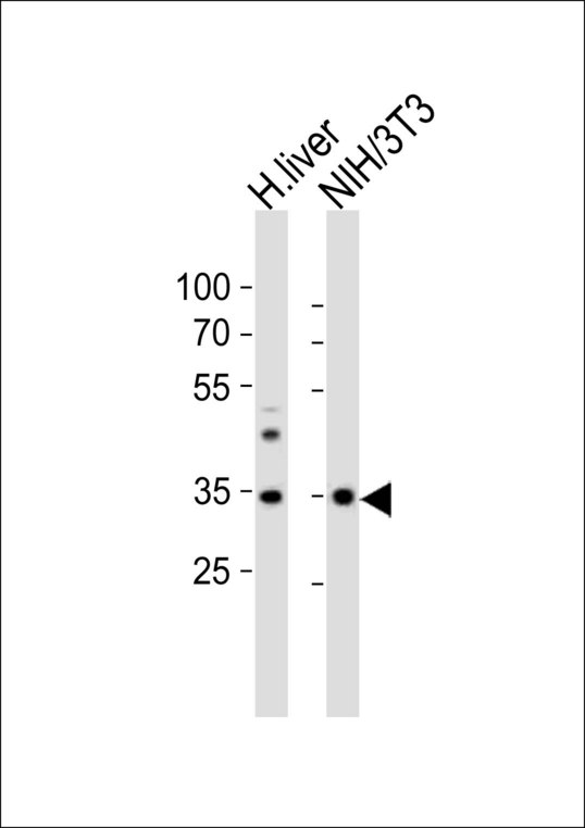 WDR5 Antibody - Western blot of lysates from human liver tissue and mouse NIH/3T3 cell line (from left to right) with (Mouse) Wdr5 Antibody. Antibody was diluted at 1:1000 at each lane. A goat anti-rabbit IgG H&L (HRP) at 1:10000 dilution was used as the secondary antibody. Lysates at 20 ug per lane.