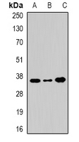 WDR5 Antibody - Western blot analysis of WDR5 expression in 22RV1 (A); BT474 (B); HeLa (C) whole cell lysates.