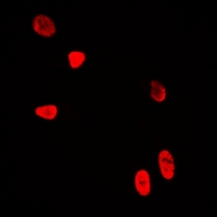 WDR5 Antibody - Immunofluorescent analysis of WDR5 staining in U2OS cells. Formalin-fixed cells were permeabilized with 0.1% Triton X-100 in TBS for 5-10 minutes and blocked with 3% BSA-PBS for 30 minutes at room temperature. Cells were probed with the primary antibody in 3% BSA-PBS and incubated overnight at 4 deg C in a humidified chamber. Cells were washed with PBST and incubated with a DyLight 594-conjugated secondary antibody (red) in PBS at room temperature in the dark.