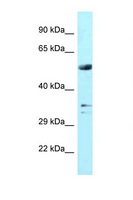 WDR54 Antibody - WDR54 antibody Western blot of Fetal Brain lysate. Antibody concentration 1 ug/ml.  This image was taken for the unconjugated form of this product. Other forms have not been tested.