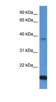 WDR54 Antibody - WDR54 antibody Western blot of Fetal Lung lysate.  This image was taken for the unconjugated form of this product. Other forms have not been tested.
