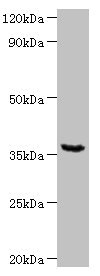 WDR54 Antibody - Western blot All lanes: WD repeat-containing protein 54 at 2µg/ml + Mouse stomach tissue Secondary Goat polyclonal to rabbit IgG at 1/10000 dilution Predicted band size: 36 kDa Observed band size: 36 kDa