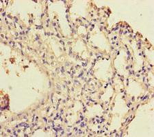 WDR54 Antibody - Immunohistochemistry of paraffin-embedded human lung tissue using WDR54 Antibody at dilution of 1:100