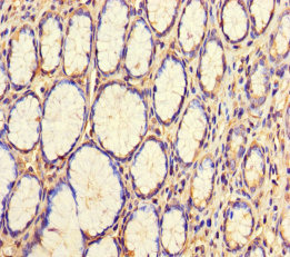 WDR54 Antibody - Immunohistochemistry of paraffin-embedded human stomach tissue using WDR54 Antibody at dilution of 1:100