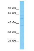 WDR57 Antibody - WDR57 antibody Western Blot of Fetal Kidney. Antibody dilution: 1 ug/ml.  This image was taken for the unconjugated form of this product. Other forms have not been tested.