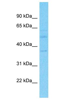WDR57 Antibody - WDR57 antibody Western Blot of Fetal Kidney. Antibody dilution: 1 ug/ml.  This image was taken for the unconjugated form of this product. Other forms have not been tested.