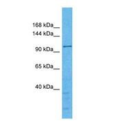 WDR59 Antibody - Western blot of Human MCF7. WDR59 antibody dilution 1.0 ug/ml.  This image was taken for the unconjugated form of this product. Other forms have not been tested.