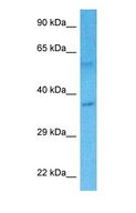 WDR5B Antibody - Western blot of WDR5B Antibody with human Stomach Tumor lysate.  This image was taken for the unconjugated form of this product. Other forms have not been tested.