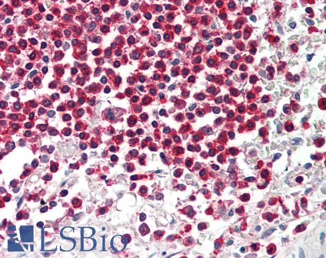 WDR6 Antibody - Anti-WDR6 antibody IHC staining of human spleen. Immunohistochemistry of formalin-fixed, paraffin-embedded tissue after heat-induced antigen retrieval. Antibody concentration 10 ug/ml.  This image was taken for the unconjugated form of this product. Other forms have not been tested.