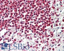 WDR6 Antibody - Anti-WDR6 antibody IHC staining of human spleen. Immunohistochemistry of formalin-fixed, paraffin-embedded tissue after heat-induced antigen retrieval. Antibody concentration 10 ug/ml.  This image was taken for the unconjugated form of this product. Other forms have not been tested.