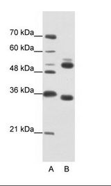WDR6 Antibody - A: Marker, B: Jurkat Cell Lysate.  This image was taken for the unconjugated form of this product. Other forms have not been tested.