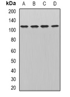 WDR6 Antibody - Western blot analysis of WDR6 expression in HeLa (A); HepG2 (B); mouse brain (C); mouse liver (D) whole cell lysates.