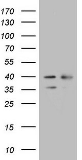 WDR61 Antibody - HEK293T cells were transfected with the pCMV6-ENTRY control. (Left lane) or pCMV6-ENTRY WDR61. (Right lane) cDNA for 48 hrs and lysed. Equivalent amounts of cell lysates. (5 ug per lane) were separated by SDS-PAGE and immunoblotted with anti-WDR61. (1:2000)