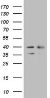 WDR61 Antibody - HEK293T cells were transfected with the pCMV6-ENTRY control. (Left lane) or pCMV6-ENTRY WDR61. (Right lane) cDNA for 48 hrs and lysed. Equivalent amounts of cell lysates. (5 ug per lane) were separated by SDS-PAGE and immunoblotted with anti-WDR61. (1:2000)
