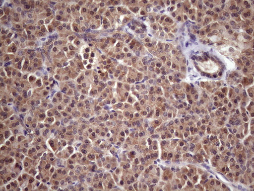 WDR61 Antibody - Immunohistochemical staining of paraffin-embedded Human pancreas tissue within the normal limits using anti-WDR61 mouse monoclonal antibody. (Heat-induced epitope retrieval by 1 mM EDTA in 10mM Tris, pH8.5, 120C for 3min. (1:150)