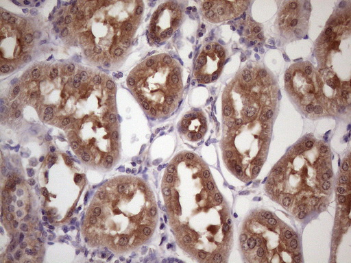 WDR61 Antibody - Immunohistochemical staining of paraffin-embedded Human Kidney tissue within the normal limits using anti-WDR61 mouse monoclonal antibody. (Heat-induced epitope retrieval by 1 mM EDTA in 10mM Tris, pH8.5, 120C for 3min. (1:150)