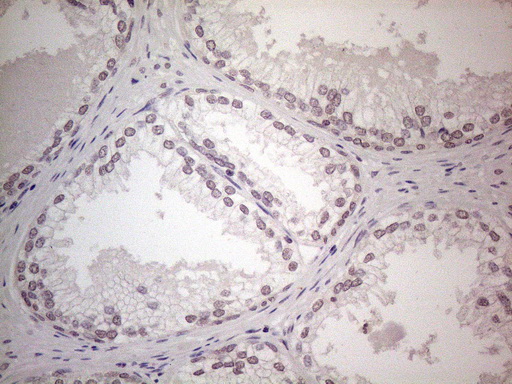 WDR61 Antibody - Immunohistochemical staining of paraffin-embedded Human prostate tissue within the normal limits using anti-WDR61 mouse monoclonal antibody. (Heat-induced epitope retrieval by 1mM EDTA in 10mM Tris buffer. (pH8.5) at 120°C for 3 min. (1:150)
