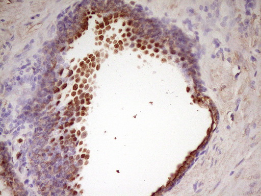 WDR61 Antibody - Immunohistochemical staining of paraffin-embedded Human prostate tissue within the normal limits using anti-WDR61 mouse monoclonal antibody. (Heat-induced epitope retrieval by 1 mM EDTA in 10mM Tris, pH8.5, 120C for 3min,