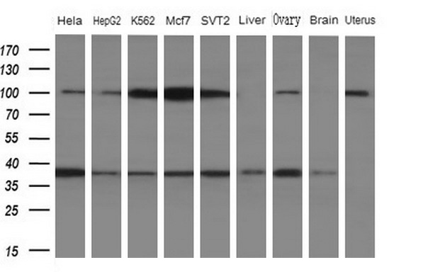 WDR61 Antibody - Western blot analysis of extracts. (10ug) from 5 different cell lines and 4 human tissue by using anti-WDR61 monoclonal antibody. (1: Hela; 2: HepG2; 3: K562; 4: Mcf7; 5: SVT2; 6: Liver; 7: Testis; 8: Brain; 9: Uterus)at 1:200 dilution.