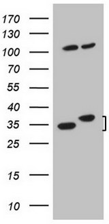 WDR61 Antibody - HEK293T cells were transfected with the pCMV6-ENTRY control (Left lane) or pCMV6-ENTRY WDR61 (Right lane) cDNA for 48 hrs and lysed. Equivalent amounts of cell lysates (5 ug per lane) were separated by SDS-PAGE and immunoblotted with anti-WDR61.
