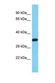 WDR61 Antibody - Western blot of Human HeLa. WDR61 antibody dilution 1.0 ug/ml.  This image was taken for the unconjugated form of this product. Other forms have not been tested.