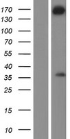 WDR62 Protein - Western validation with an anti-DDK antibody * L: Control HEK293 lysate R: Over-expression lysate