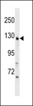 WDR64 Antibody - WDR64 Antibody western blot of mouse kidney tissue lysates (35 ug/lane). The WDR64 antibody detected the WDR64 protein (arrow).