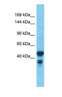 WDR66 Antibody - Western blot of WDR66 Antibody with human Colorectal Tumor lysate.  This image was taken for the unconjugated form of this product. Other forms have not been tested.