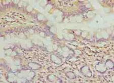 WDR66 Antibody - Immunohistochemistry of paraffin-embedded human small intestine tissue using antibody at dilution of 1:100.