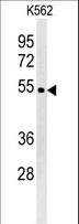 WDR73 Antibody - WDR73 Antibody western blot of K562 cell line lysates (35 ug/lane). The WDR73 antibody detected the WDR73 protein (arrow).