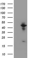 WDR74 Antibody - HEK293T cells were transfected with the pCMV6-ENTRY control (Left lane) or pCMV6-ENTRY WDR74 (Right lane) cDNA for 48 hrs and lysed. Equivalent amounts of cell lysates (5 ug per lane) were separated by SDS-PAGE and immunoblotted with anti-WDR74.