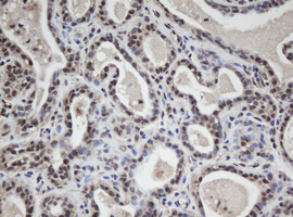 WDR74 Antibody - IHC of paraffin-embedded Human breast tissue using anti-WDR74 mouse monoclonal antibody. (Heat-induced epitope retrieval by 10mM citric buffer, pH6.0, 100C for 10min).