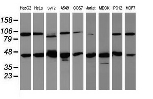 WDR74 Antibody - Western blot of extracts (35 ug) from 9 different cell lines by using anti-WDR74 monoclonal antibody (HepG2: human; HeLa: human; SVT2: mouse; A549: human; COS7: monkey; Jurkat: human; MDCK: canine; PC12: rat; MCF7: human).