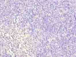 WDR74 Antibody - Immunohistochemistry of paraffin-embedded human thymus tissue using antibody at dilution of 1:100.