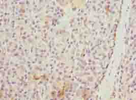 WDR74 Antibody - Immunohistochemistry of paraffin-embedded human pancreatic tissue using antibody at dilution of 1:100.