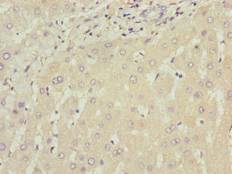 WDR74 Antibody - Immunohistochemistry of paraffin-embedded human liver tissue using WDR74 Antibody at dilution of 1:100