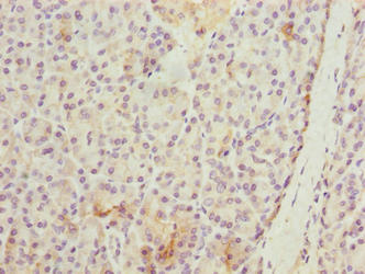 WDR74 Antibody - Immunohistochemistry of paraffin-embedded human pancreatic tissue using WDR74 Antibody at dilution of 1:100