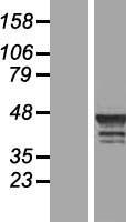WDR74 Protein - Western validation with an anti-DDK antibody * L: Control HEK293 lysate R: Over-expression lysate