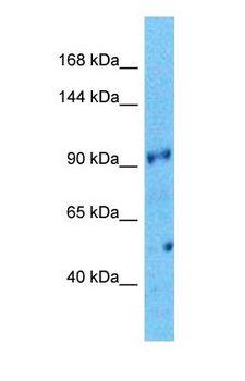 WDR75 Antibody - Western blot of WDR75 Antibody with human ACHN Whole Cell lysate.  This image was taken for the unconjugated form of this product. Other forms have not been tested.