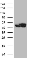 WDR77 / MEP50 Antibody - HEK293T cells were transfected with the pCMV6-ENTRY control. (Left lane) or pCMV6-ENTRY WDR77. (Right lane) cDNA for 48 hrs and lysed. Equivalent amounts of cell lysates. (5 ug per lane) were separated by SDS-PAGE and immunoblotted with anti-WDR77. (1:2000)