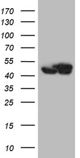 WDR77 / MEP50 Antibody - HEK293T cells were transfected with the pCMV6-ENTRY control. (Left lane) or pCMV6-ENTRY WDR77. (Right lane) cDNA for 48 hrs and lysed