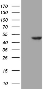 WDR77 / MEP50 Antibody - HEK293T cells were transfected with the pCMV6-ENTRY control. (Left lane) or pCMV6-ENTRY WDR77. (Right lane) cDNA for 48 hrs and lysed. Equivalent amounts of cell lysates. (5 ug per lane) were separated by SDS-PAGE and immunoblotted with anti-WDR77. (1:500)
