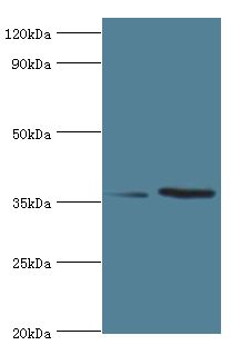 WDR77 / MEP50 Antibody - Western blot. All lanes: Methylosome protein 50 antibody at 6 ug/ml. Lane 1: HeLa whole cell lysate. Lane 2: HepG2 whole cell lysate. Secondary antibody: Goat polyclonal to rabbit at 1:10000 dilution. Predicted band size: 37 kDa. Observed band size: 37 kDa Immunohistochemistry.
